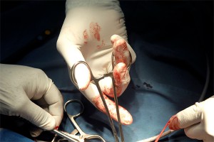 Мужчина с ножницами в голове поразил врачей Мужчина с ножницами в голове поразил врачей