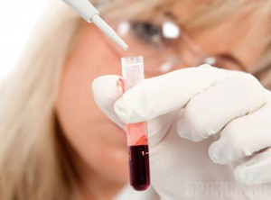 В 2014 году у 5,9 тысячи брянцев был обнаружен рак