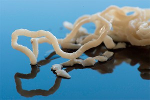 В жителях Костромы завелись ленточные черви В жителях Костромы завелись ленточные черви