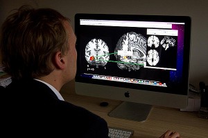 Ученые увидели в мозге "отпечатки времени" Ученые увидели в мозге "отпечатки времени"