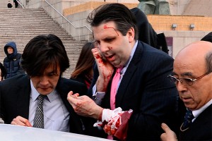 В Сеуле посла США порезали бритвой В Сеуле посла США порезали бритвой