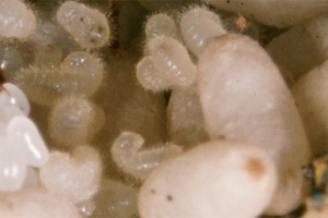 Пенсионеру вытащили сотни личинок из носа Пенсионеру вытащили сотни личинок из носа