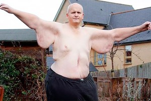 Британец похудел на 300 кг ради любимой Британец похудел на 300 кг ради любимой