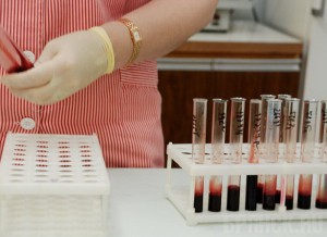 В 2014 году выявлено более 280 ВИЧ-инфицированных брянцев