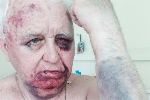 В Москве жестоко избит замдиректора школы искусств В Москве жестоко избит замдиректора школы искусств