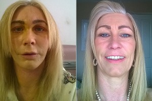 Безработная потратила детские пособия на пластику Безработная потратила детские пособия на пластику