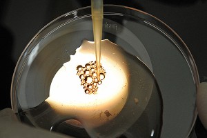 Oнкологию у Фриске могла вызвать процедура ЭКО Oнкологию у Фриске могла вызвать процедура ЭКО