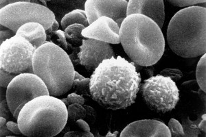 Ученые сняли на видео смерть лейкоцитов Ученые сняли на видео смерть лейкоцитов