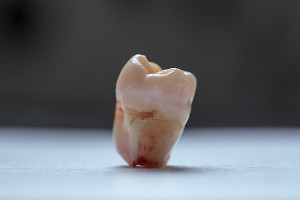 Москвичка умерла после визита к стоматологу Москвичка умерла после визита к стоматологу