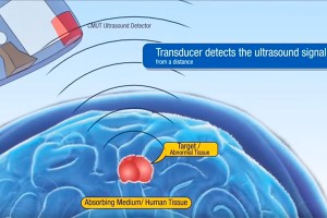 Рак лечат гаджетами из Star Trek (видео) Рак лечат гаджетами из Star Trek (видео)