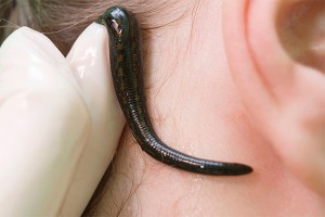 В Забайкалье из кранов течет вода с пиявками В Забайкалье из кранов течет вода с пиявками