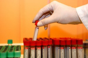 Москвич подал на жену в суд из-за ВИЧ Москвич подал на жену в суд из-за ВИЧ