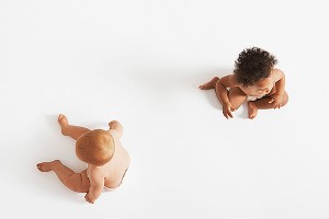 Близнецы родились с разным цветом кожи Близнецы родились с разным цветом кожи