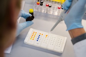 Ученые создали лекарство от СПИДа (видео) Ученые создали лекарство от СПИДа (видео)