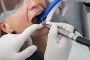 Отец няни-убийцы оживил ее удалением зуба Отец няни-убийцы оживил ее удалением зуба