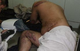 Дочь «выбивала» у отца пенсию под пытками